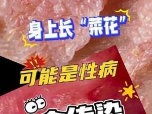 为什么像菜花状？是正常的吗？该怎么办？