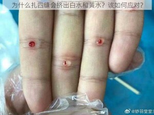 为什么扎四缝会挤出白水和黄水？该如何应对？