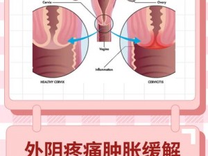 一天接了 8 个客人后，私密处为何会肿？应该如何消肿？