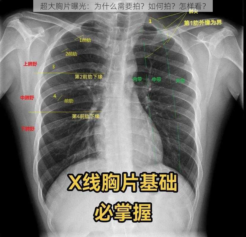 超大胸片曝光：为什么需要拍？如何拍？怎样看？