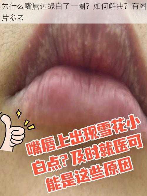 为什么嘴唇边缘白了一圈？如何解决？有图片参考