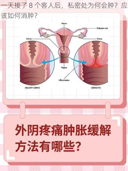 一天接了 8 个客人后，私密处为何会肿？应该如何消肿？